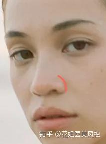 怎么做才能变成高鼻梁 v2-472aa673d60f9d0f25984dc6e1362155_b.jpg