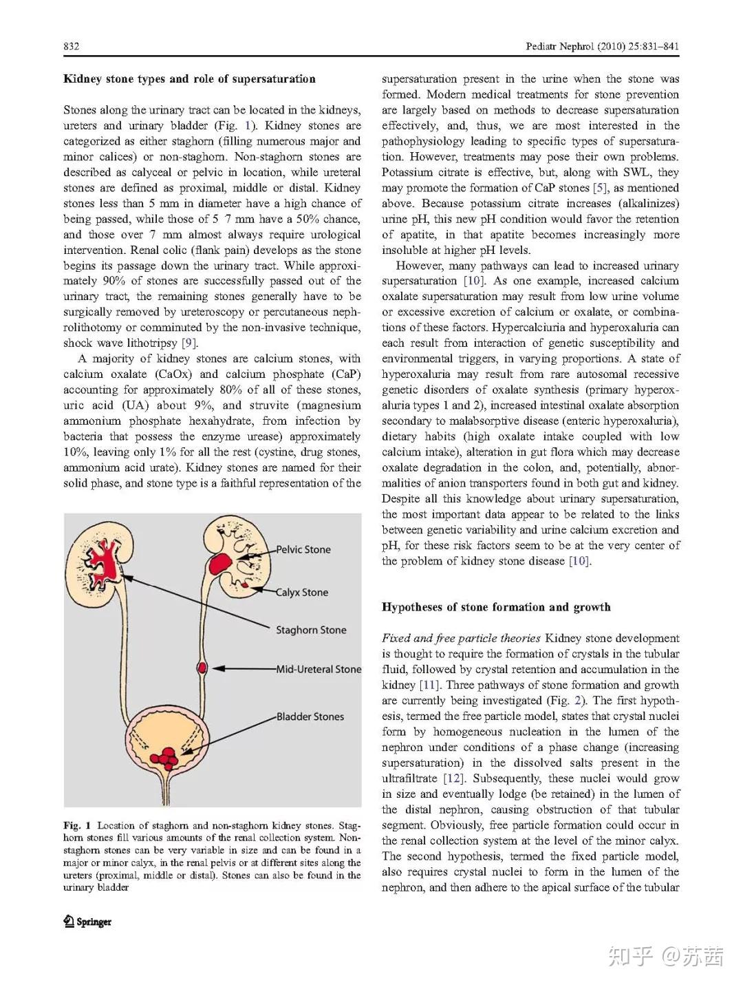 肾结石是怎么形成的1