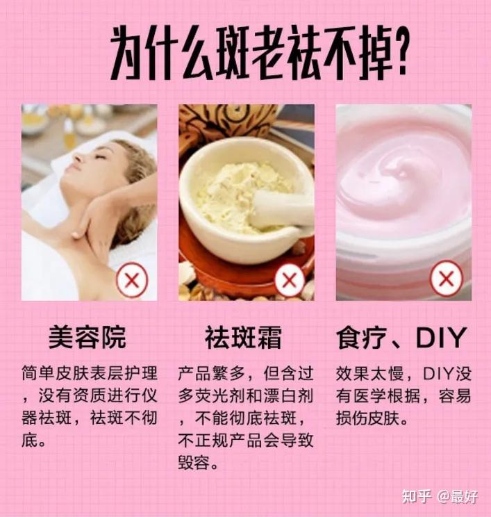 南京肤康淡化脸上雀斑要针对性治疗