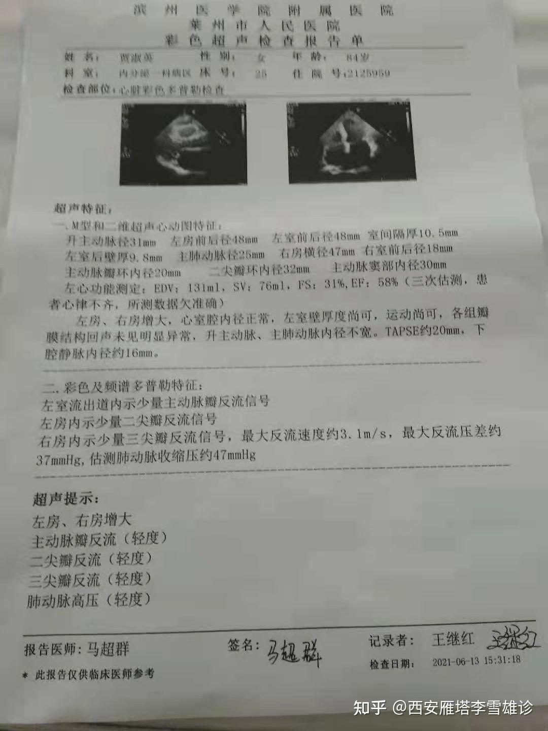 中药治好一例左心衰病案分享!