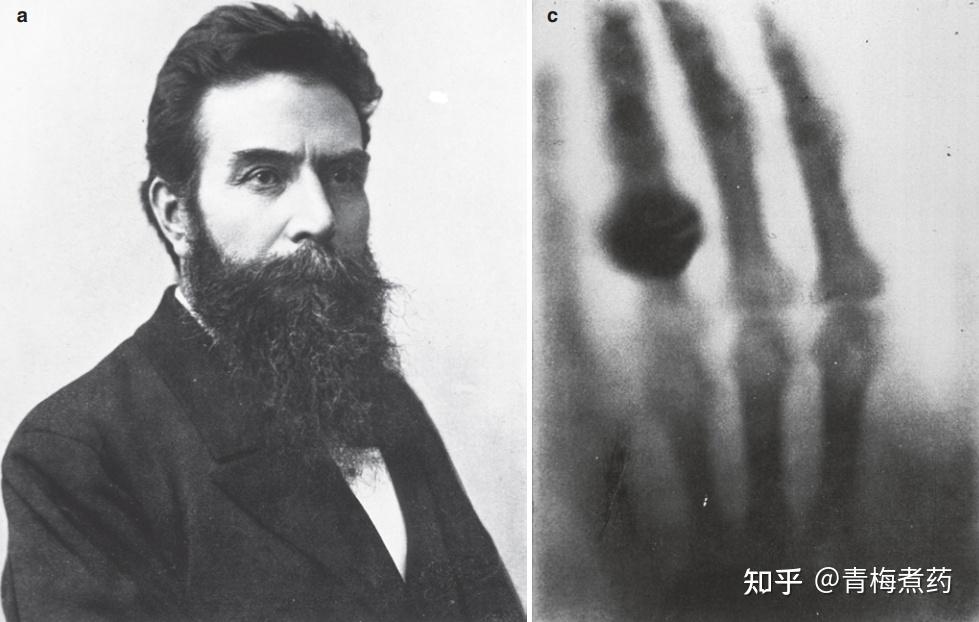核医学简史——起源 - 知乎