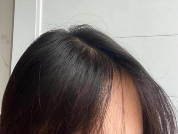 头发细、软、塌、超爱油，怎么护理头发让头顶看起来蓬松？