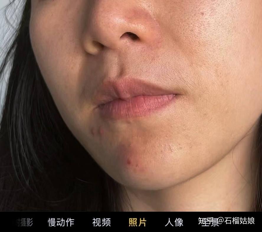 2个月,亲测大垮暗黄脸逆袭成功!皮肤水嫩紧致到苹果后置怼着拍也不怕!