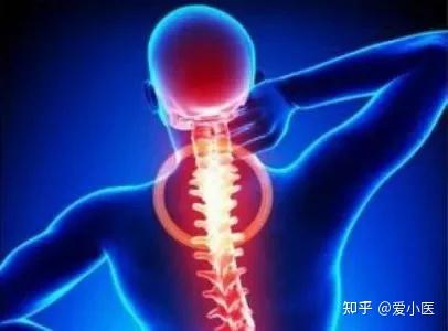 民间绝技截根疗法(挑羊毛疔)治疗方法 - 知乎