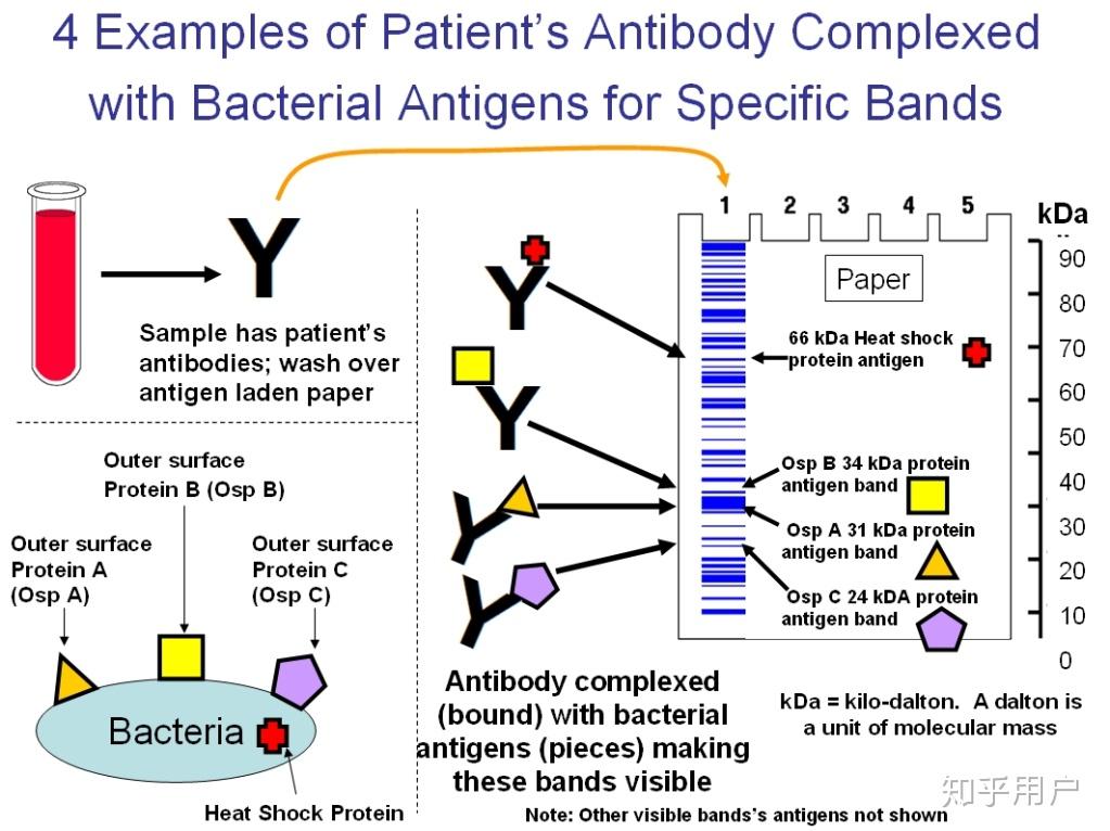 westernblot的原理是什么