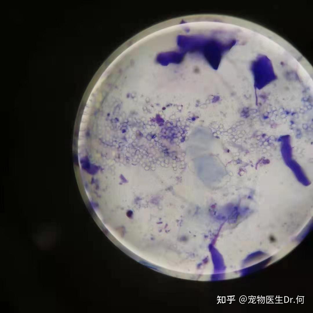 犬小孢子菌镜检图片图片