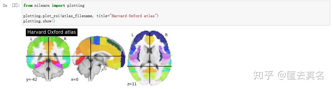 nilearn 笔记（3） - 知乎