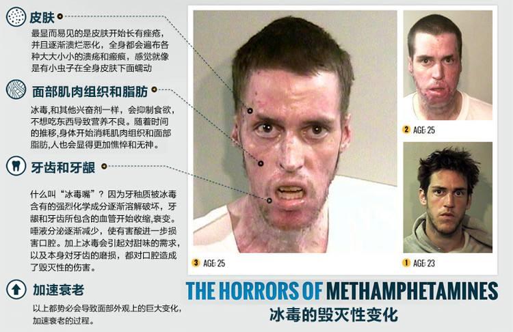 安乐死的合法性