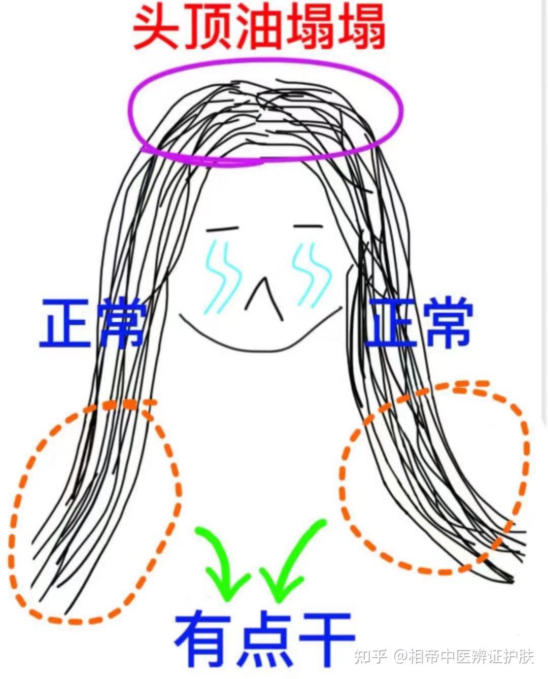网上看到一个头发出油的图，正好说一下 - 知乎