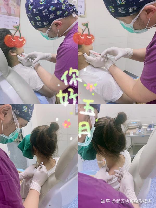 瘦脸针下颌缘提升拥有完美下颌线