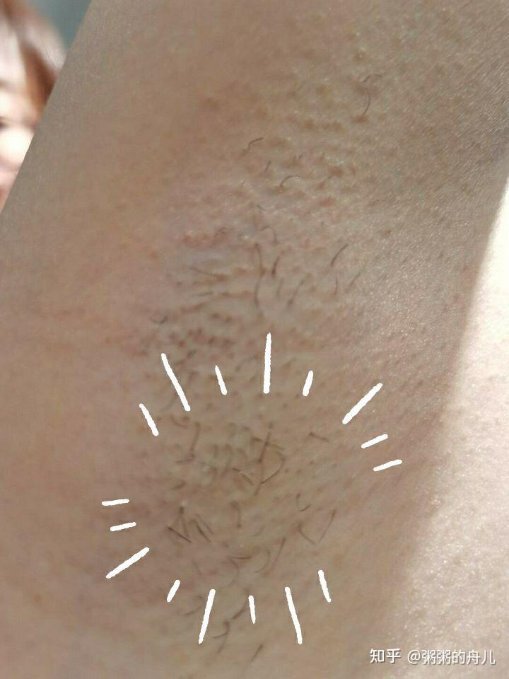 它的确没有辜负我的钱钱~脱下面毛毛的时候冰冰凉凉,体验感甩其他脱毛