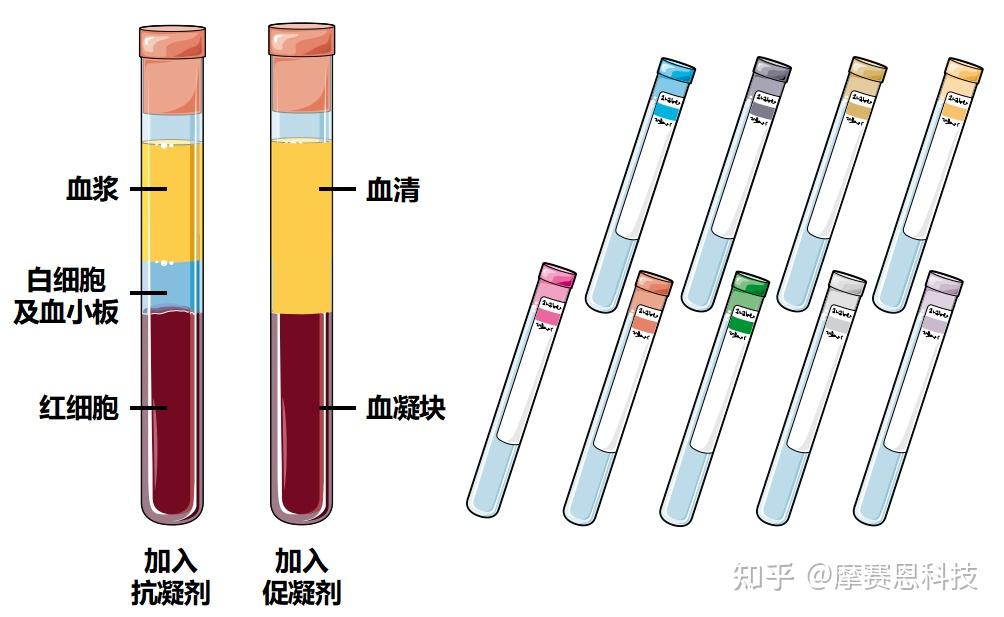 血液分层实验图图片