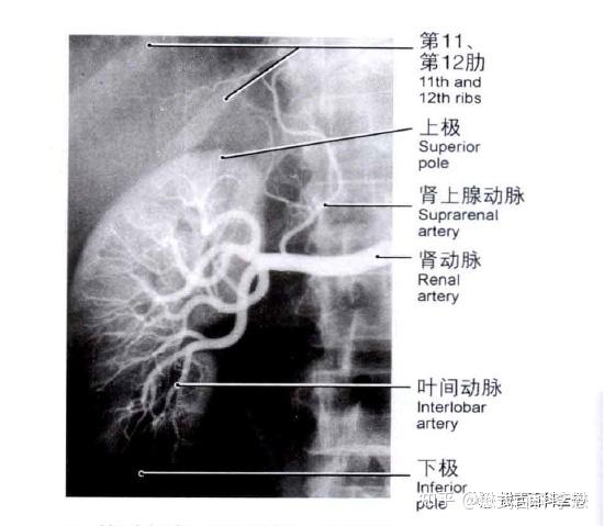 磁共振肾脏规范化扫描及临床应用(一) - 知乎