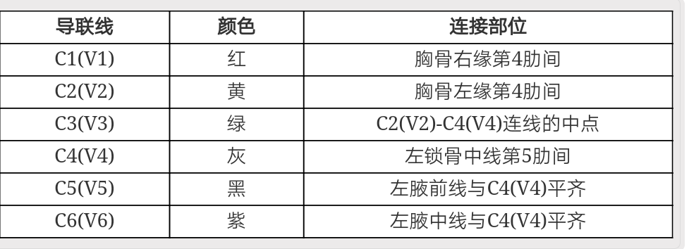 心电图12导联连接示意图