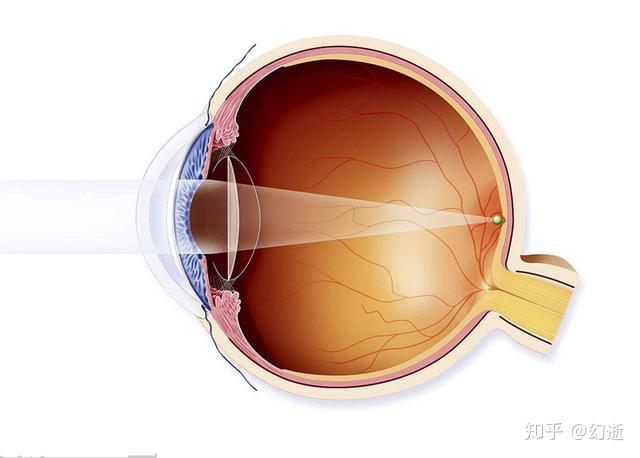 眼角膜位于前眼房,里面有种液体(眼房水),它所含