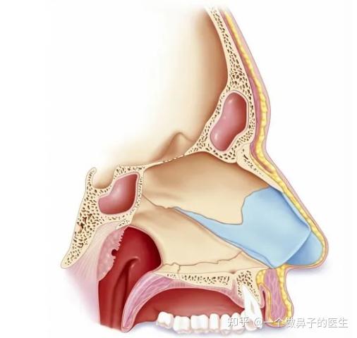 西方人主要进行大鼻子缩小术(reduction rhinoplasty).