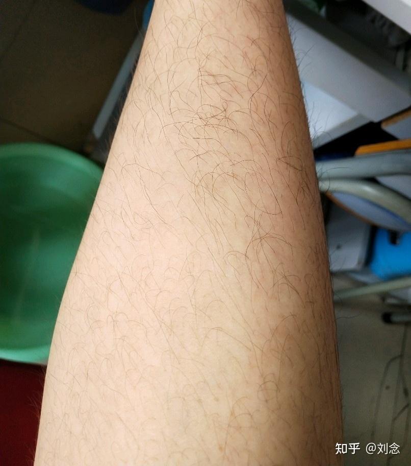 史上最有效的男士脱毛攻略!