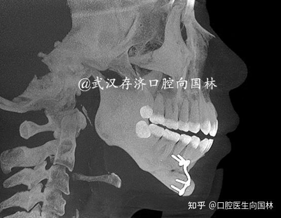 病例情况如下