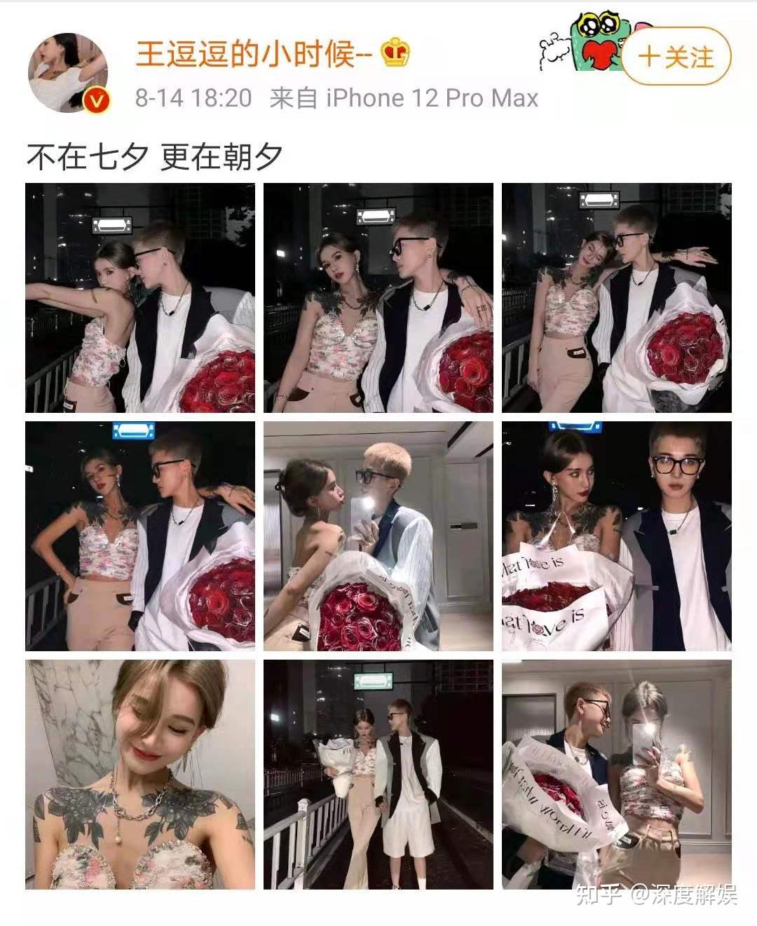 王逗逗晒出恋人车祸照眼皮青紫又流血万幸只是皮肉伤