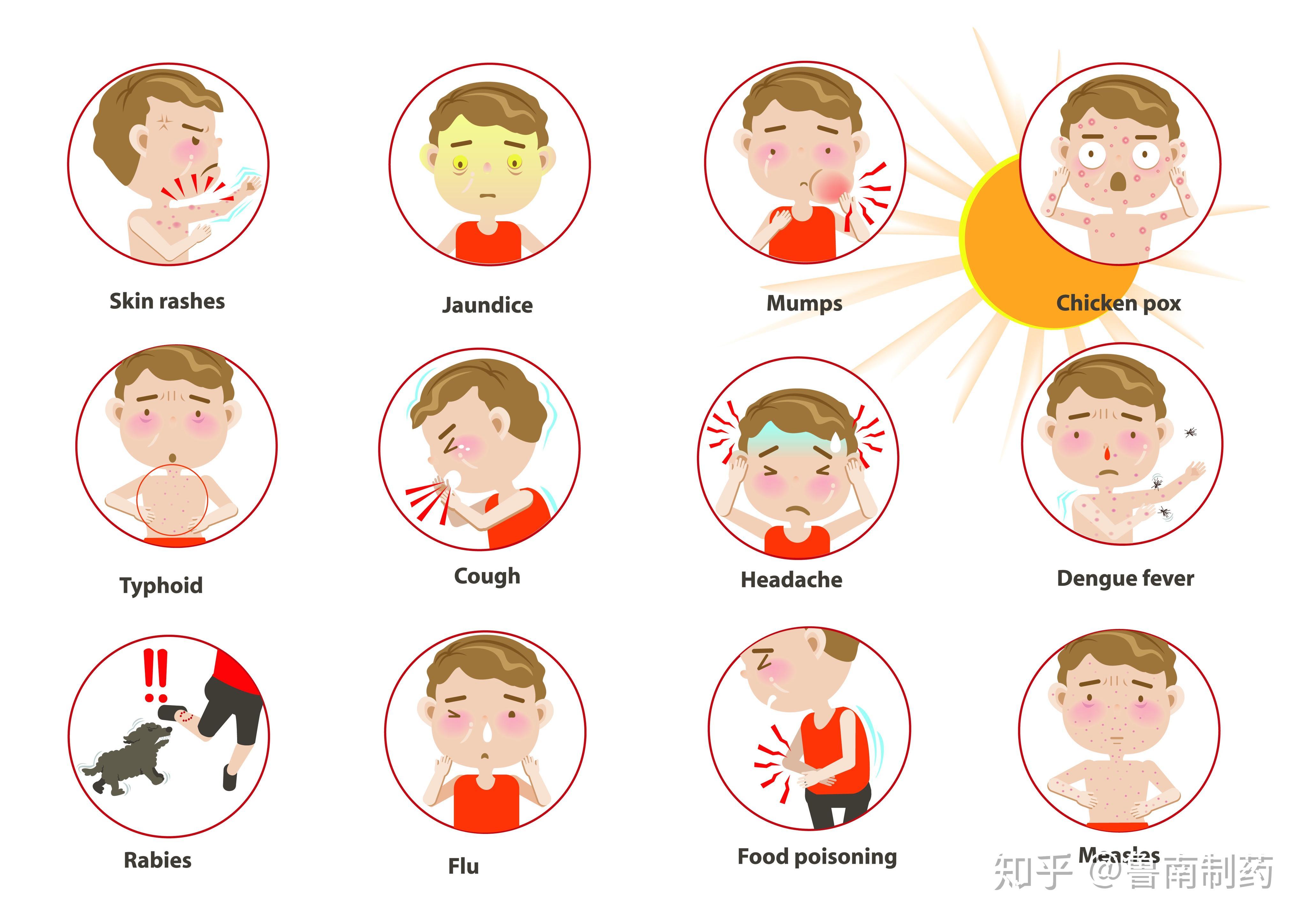 流行性腮腺炎来了！如何预防？一文读懂 - 知乎