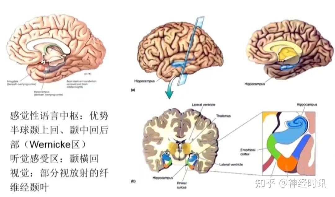 5种脑叶癫痫病症状学定位总结,一文掌握! - 知乎