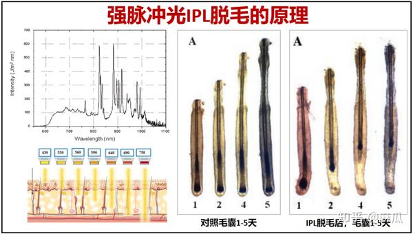 光电类的脱毛仪，为何能脱毛抑毛？家用脱毛仪效果能媲美院线是真的吗