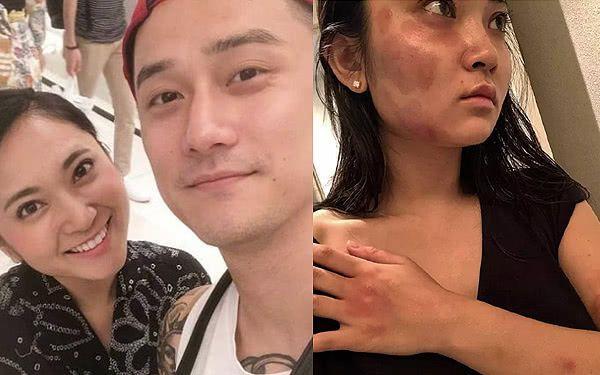 河南女子遭男友泼汽油焚烧毁容这3个细节帮你鉴别暴力渣男