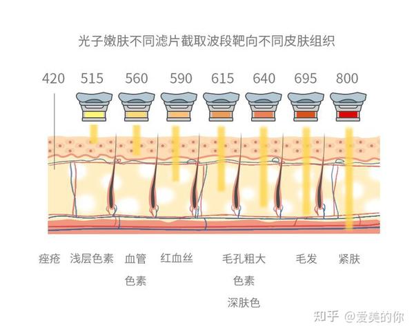 光子嫩肤的不同系列都有什么效果？ 知乎