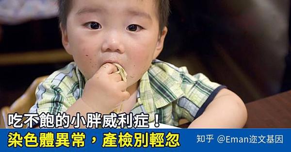 吃不饱的小胖威利症 避免染色体异常 这项产检千万别忽视 知乎