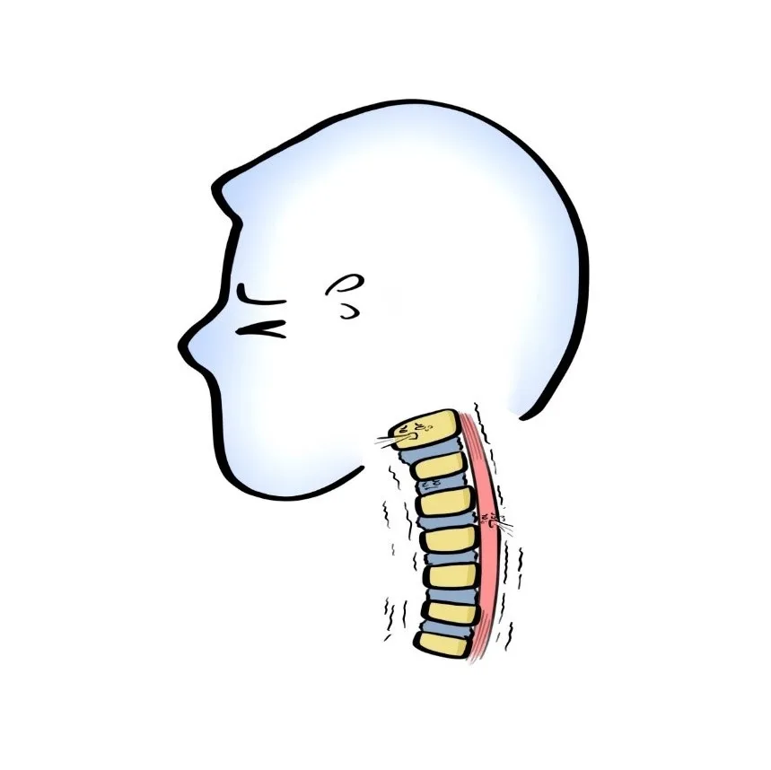 颈椎曲度变直直男直女救救你的颈椎吧