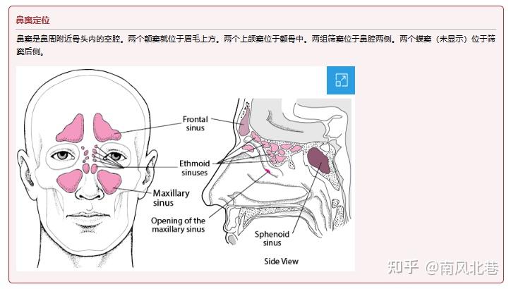 如何诊断和治疗鼻窦炎 - 知乎
