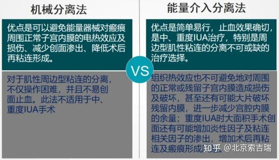 宫腔粘连的诊疗要点,快速梳理! - 知乎