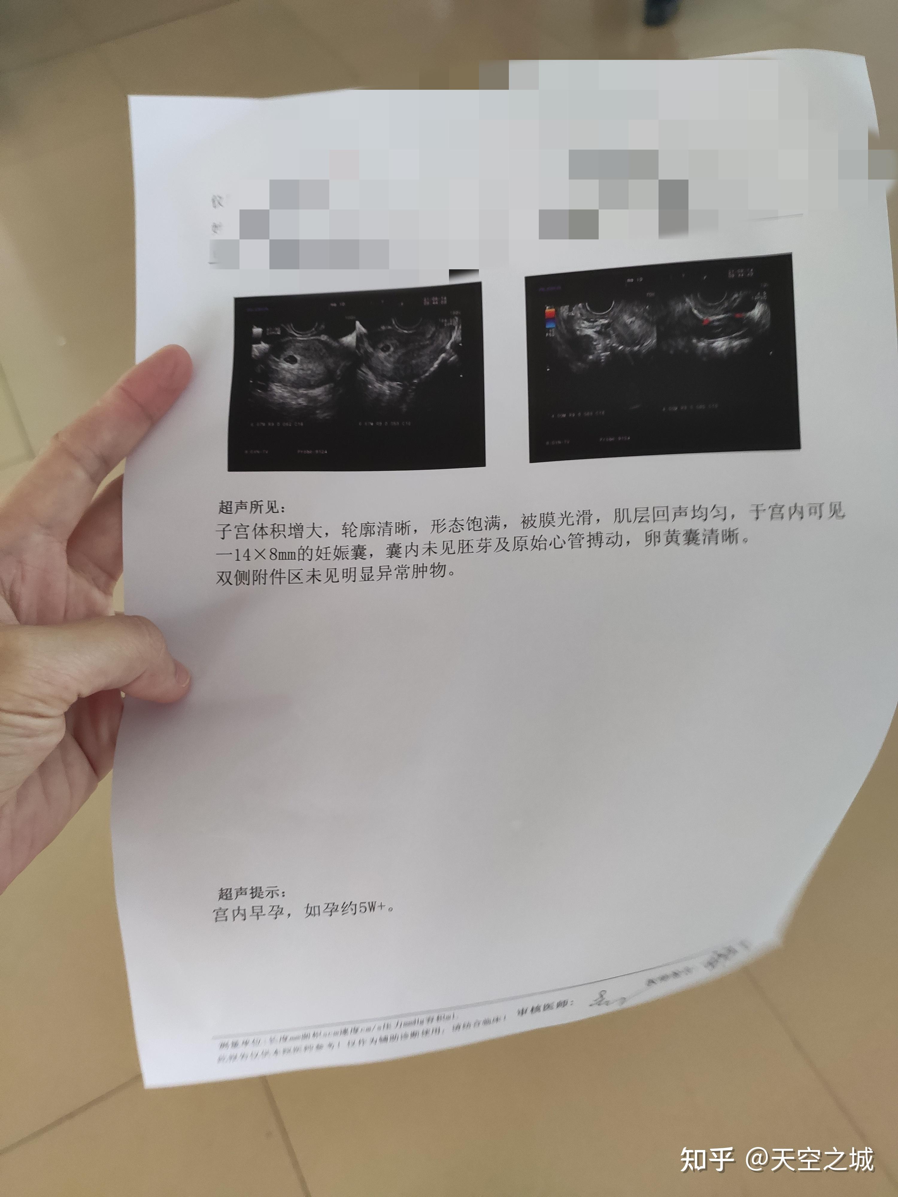 🕊最新消息药流微信货到付款分享(你知道微信货到付款可信吗吗？)