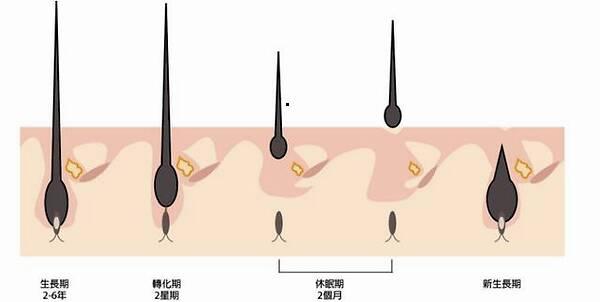 毛囊萎縮毛囊閉合毛囊壞死這三個怎麼區分