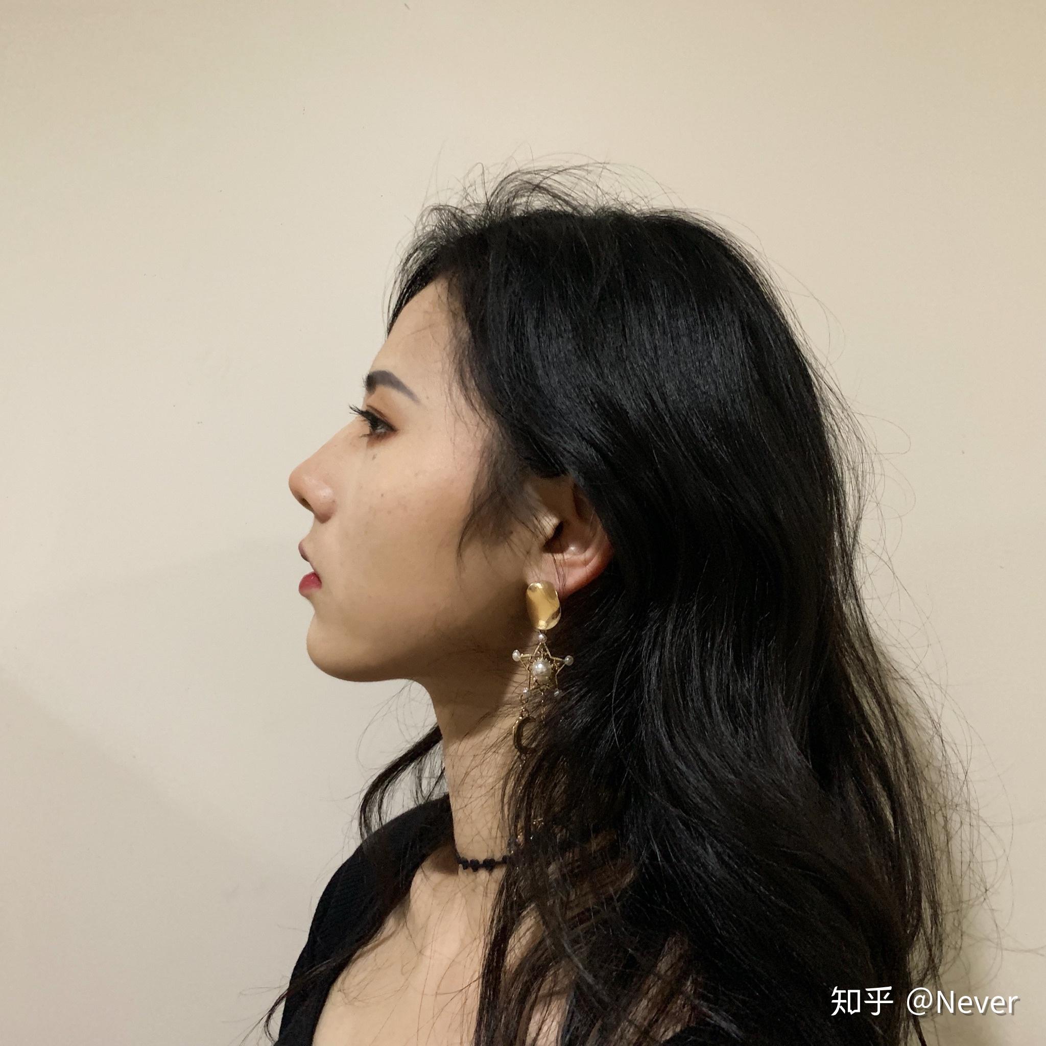 鼻子太挺拔有什么体验?