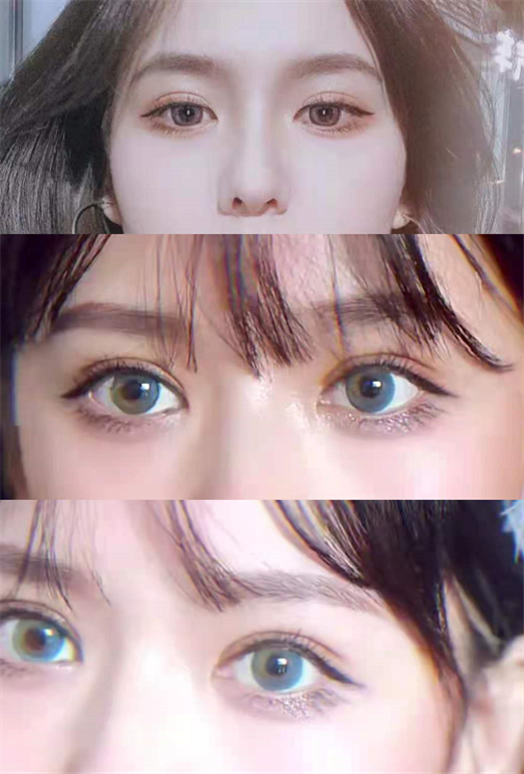 上海有哪些亲妈风的双眼皮医生三甲医院私立医院哪些靠谱白名单