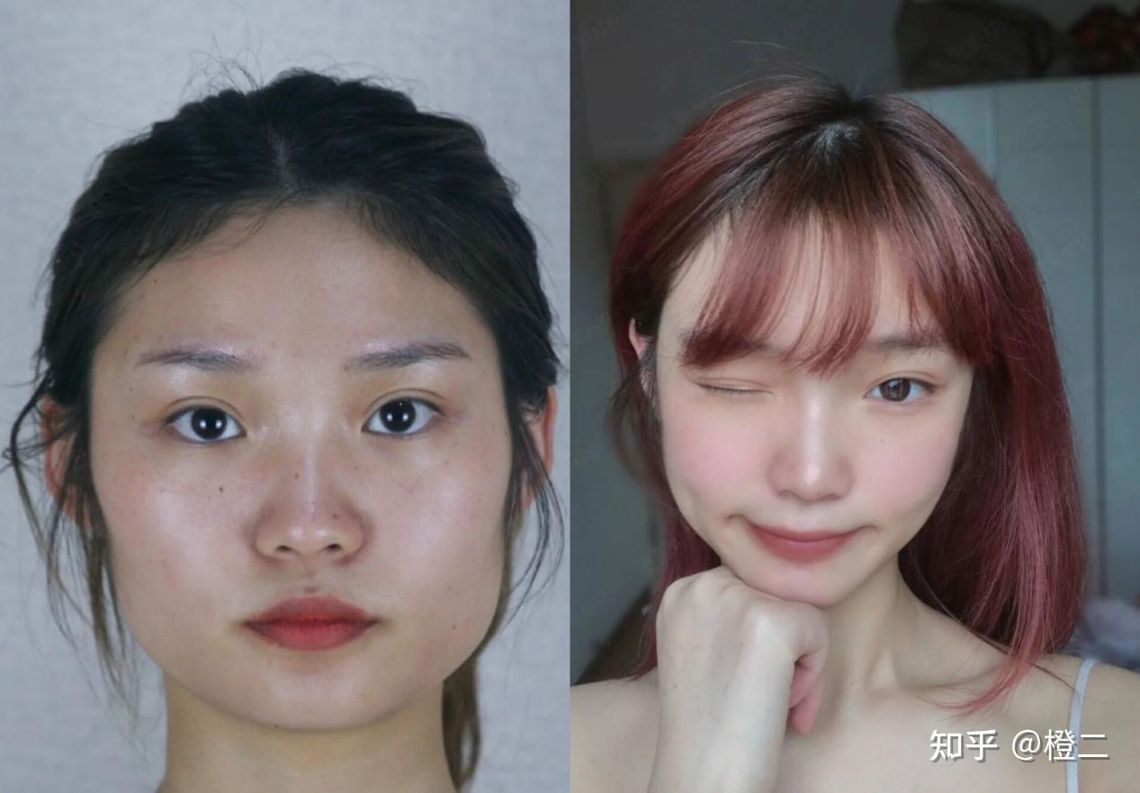 脸变大发腮怎么解决?不同类型的发腮解决攻略请你收好(附发腮测试)