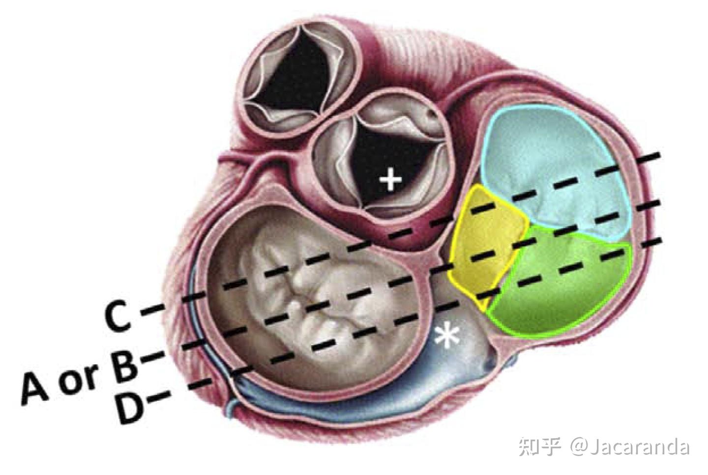 经胸心脏超声如何区分三尖瓣不同瓣叶 - 知乎