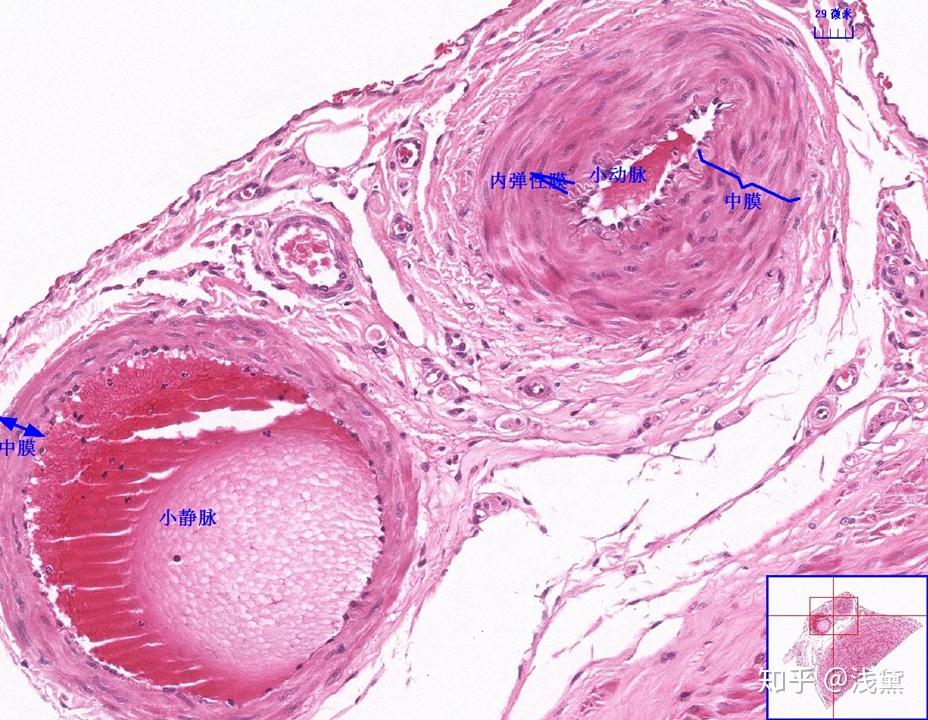 5.甲状腺(甲状腺滤泡,滤泡旁细胞)
