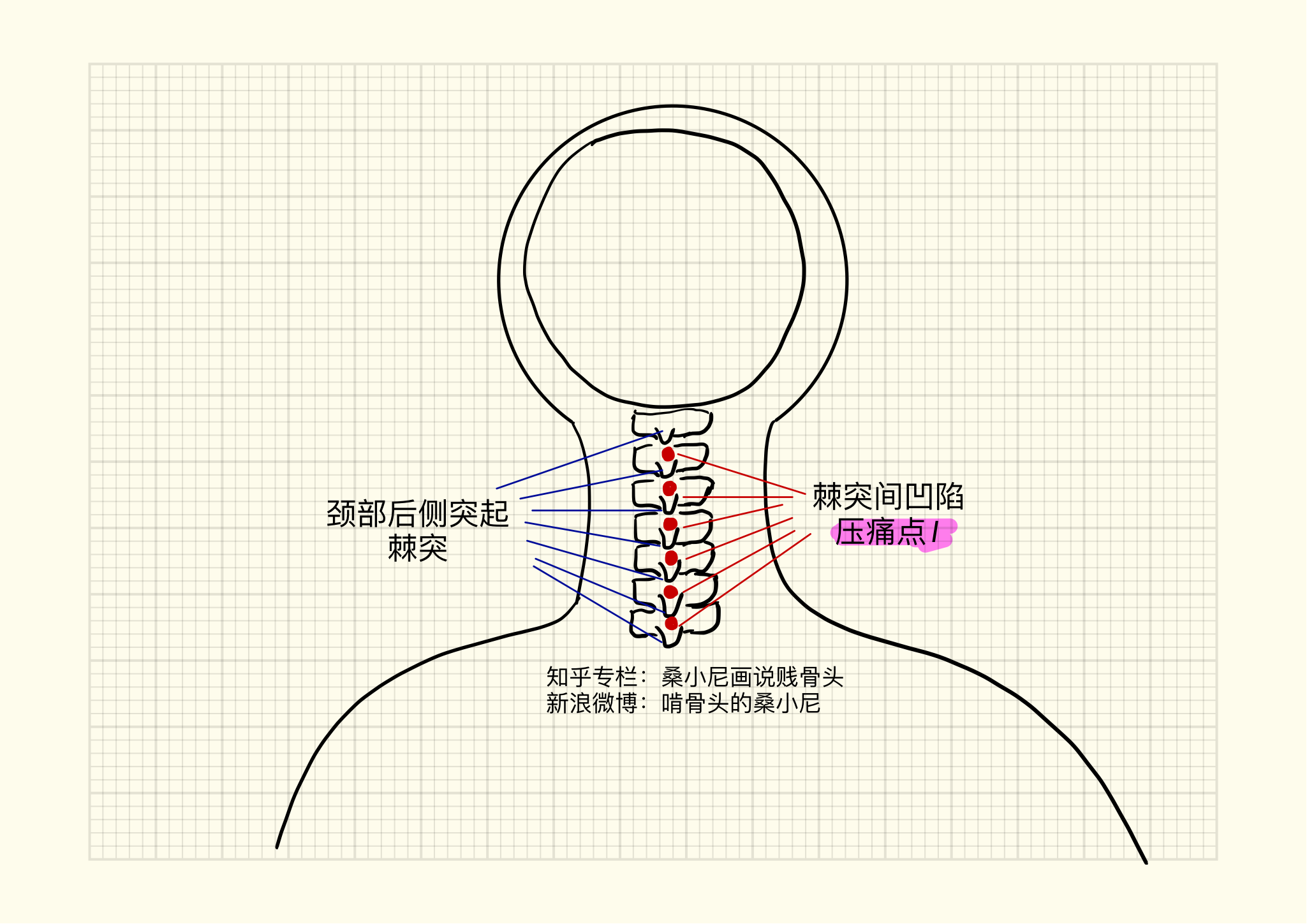 颈椎的神经分布,颈椎支配分布图,颈支配区域图_大山谷图库