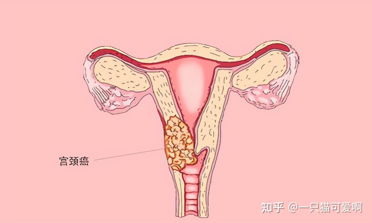 后穹窿部是什么部位图片