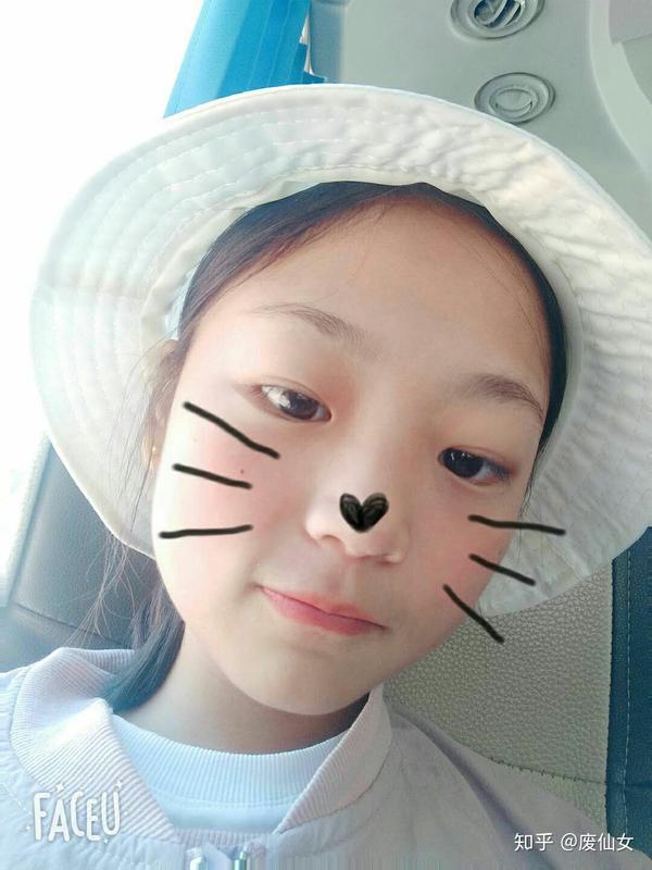 肿眼泡单眼皮塌鼻子但可爱是什么感受?