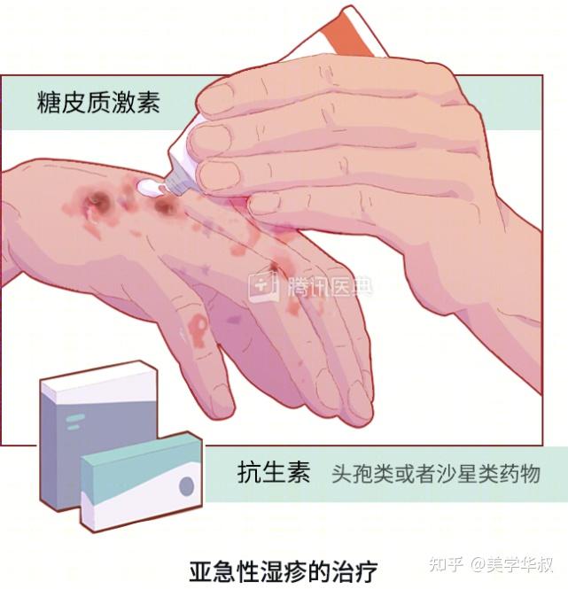 太紧张竟会引起皮肤病！压力大时学会这3个方法 - 知乎