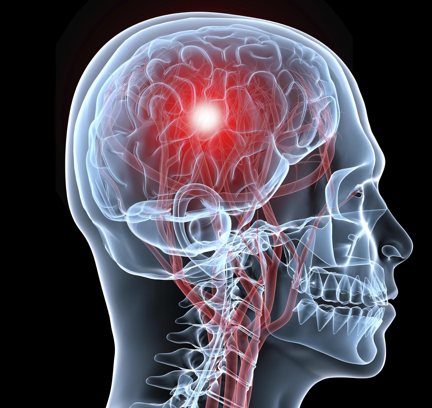 v2-4c101c8bf86fad876fecb9165d6d4ac5_1440w.jpg?source=172ae18b