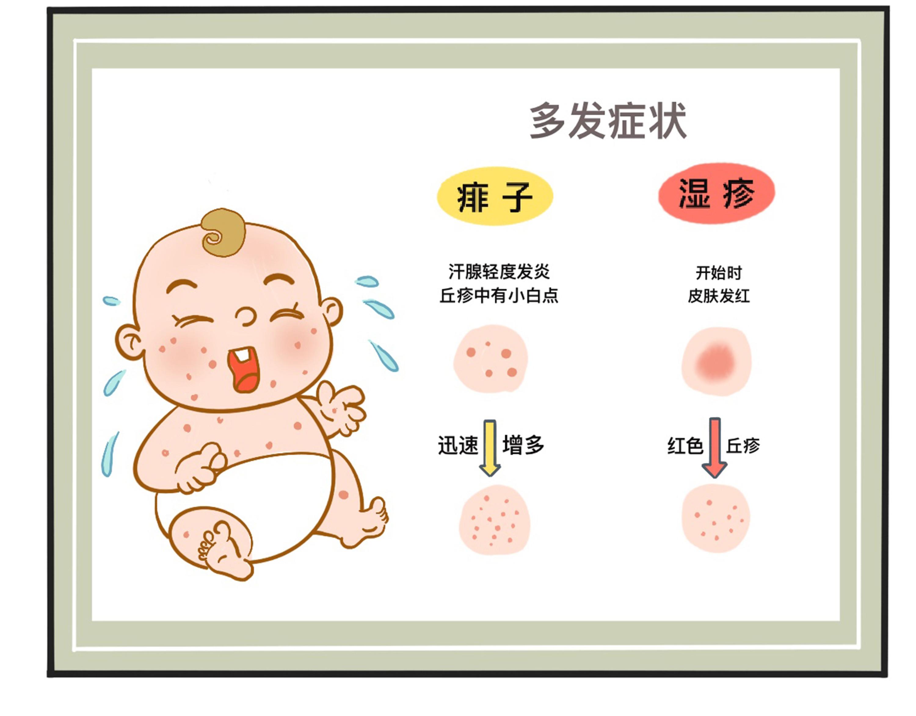 大头娃娃激素图片