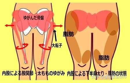 大白話講就是從人體某些部位吸取多餘的皮下脂肪細胞,然後將吸出的