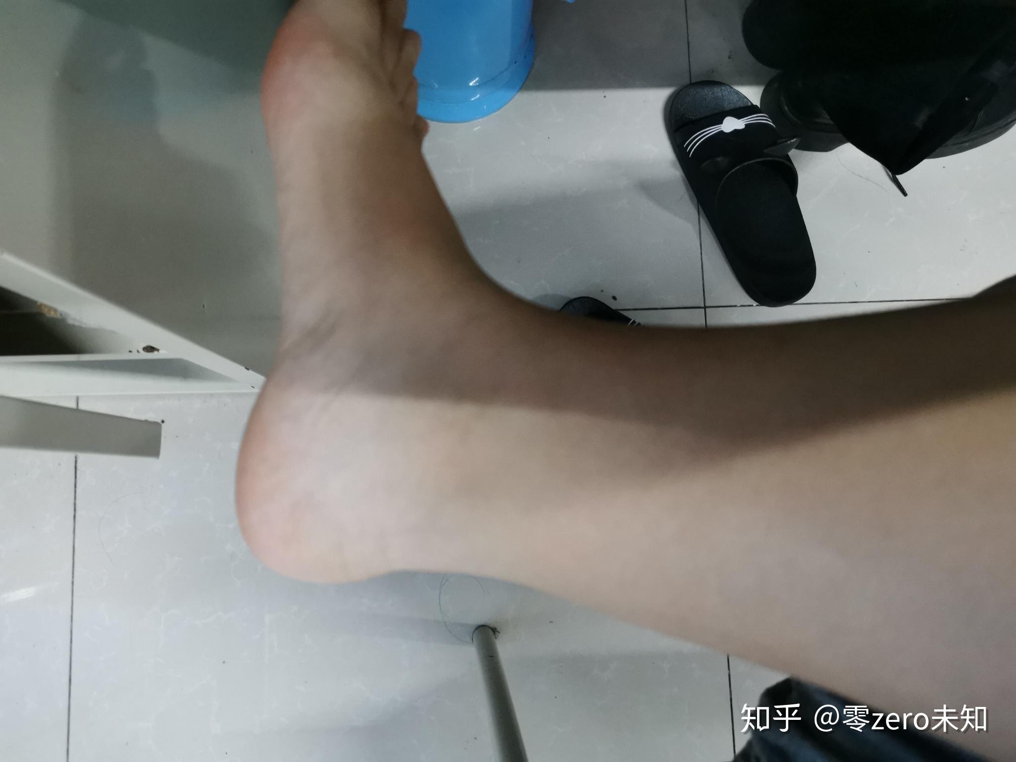 继肚脐贴没啥效果之后,我对我的粗脚脖子受不了了!