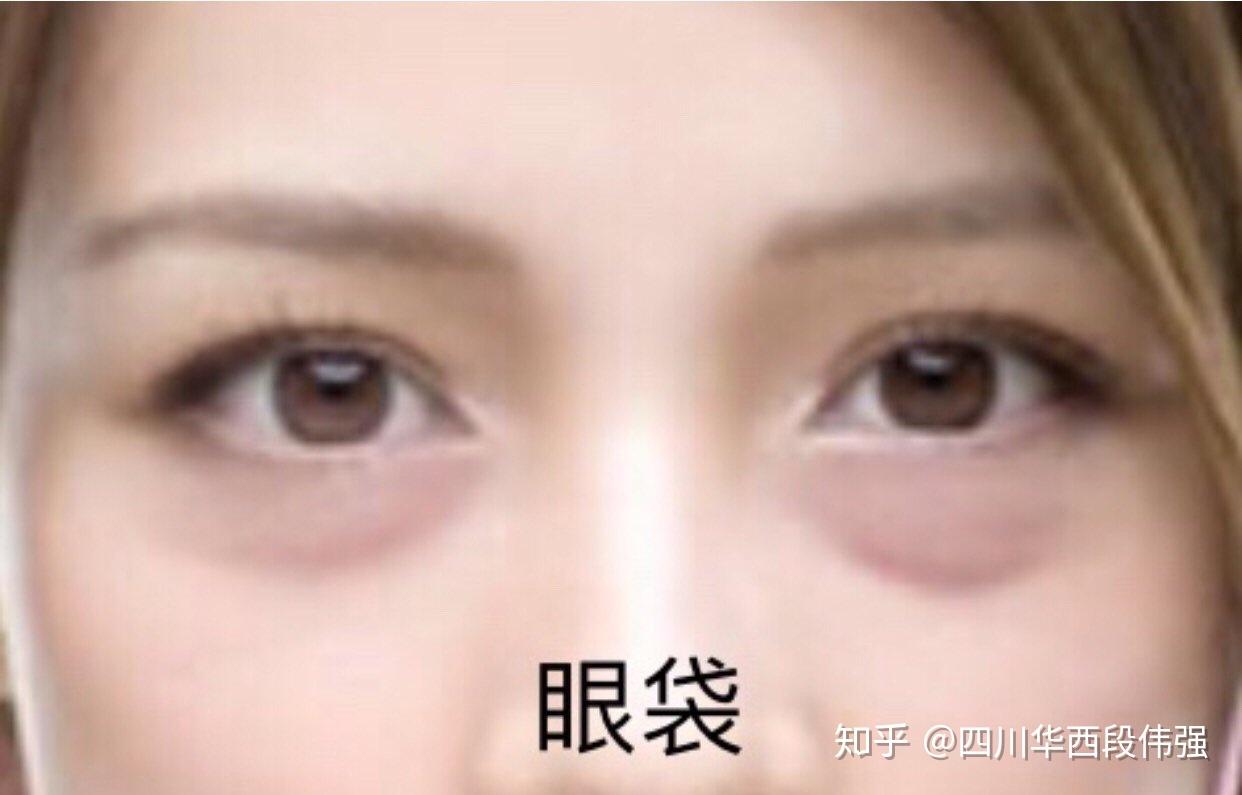 v2-4c8dd8f19fa646a7a2da7f905ef79fb8_r.jpg