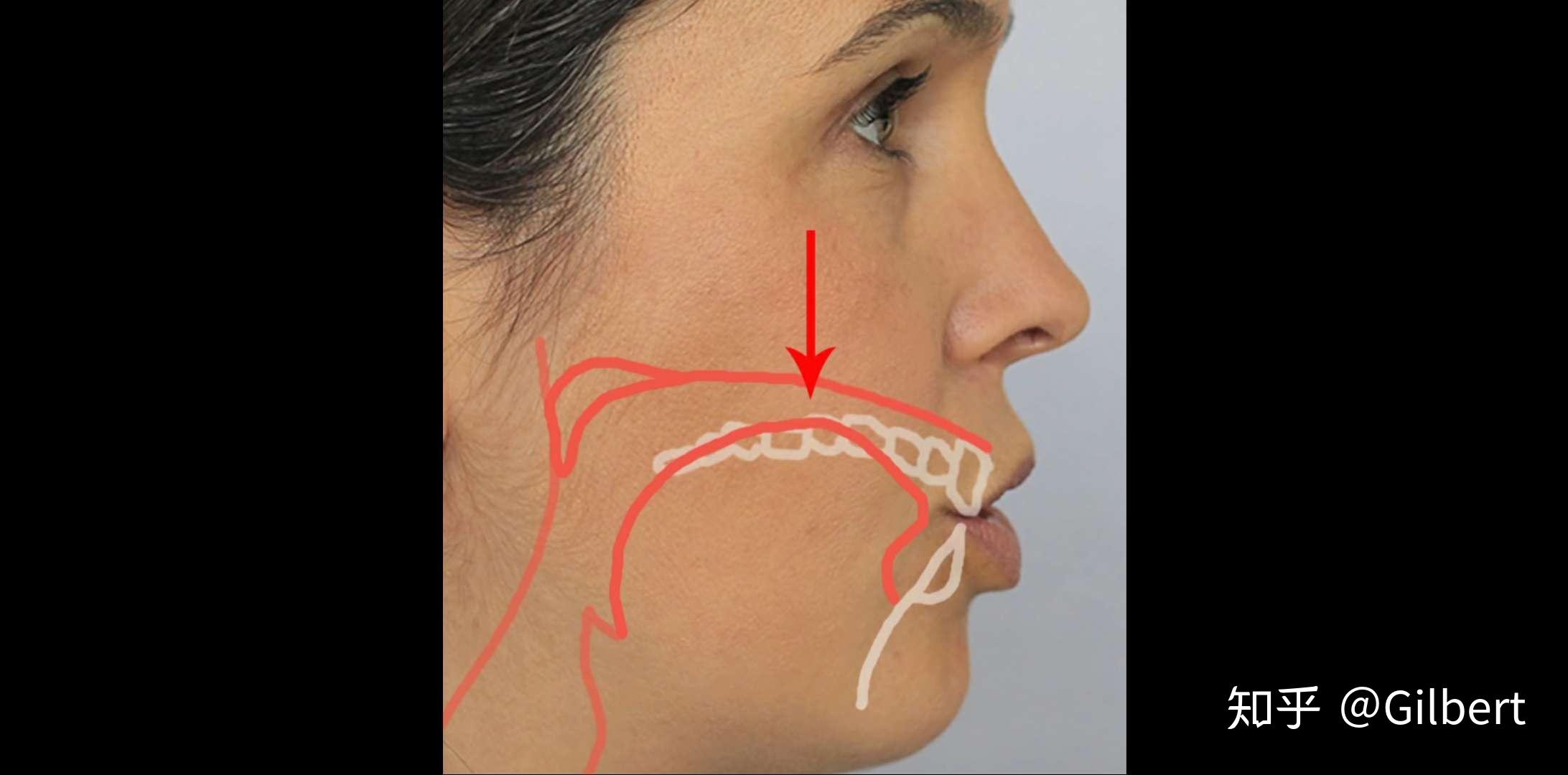 舌头抵住上颚改变脸型图片