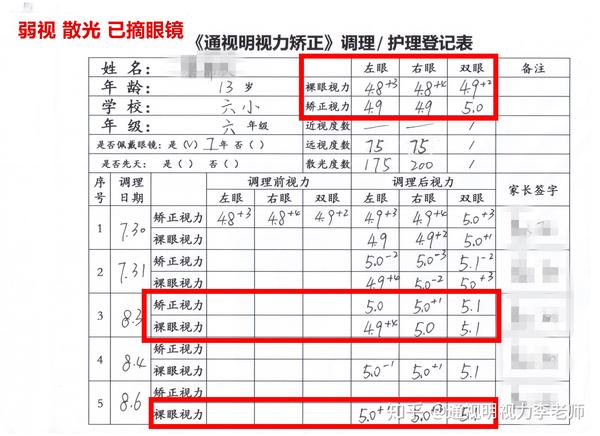 球镜和柱镜对照表正常图片